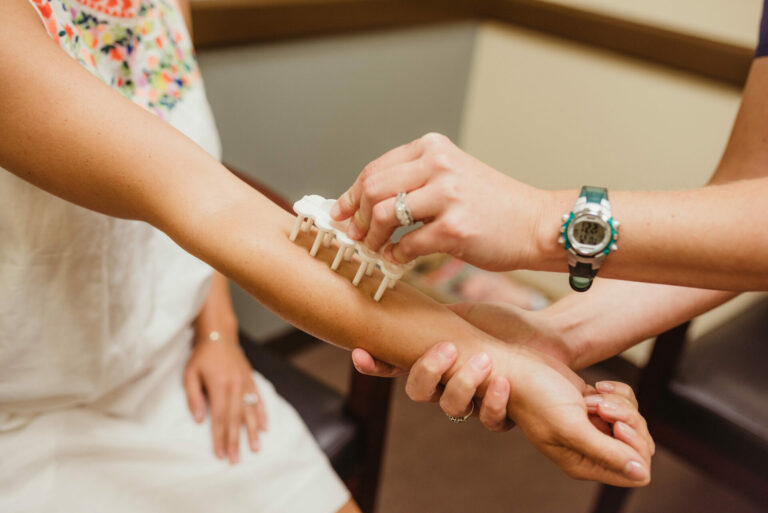 Top 5 Things You Should Know About Allergy Skin Testing Allergy and